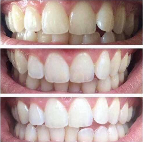 99.png__PID:5d2ea5d0-eeed-4dc1-b480-32dad6368d43