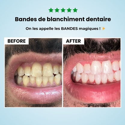 Blanchiment Ultime MAX | V34 + MAX Bandes
